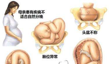 顺产和剖腹产都经历过的说说,顺产无侧切无撕裂