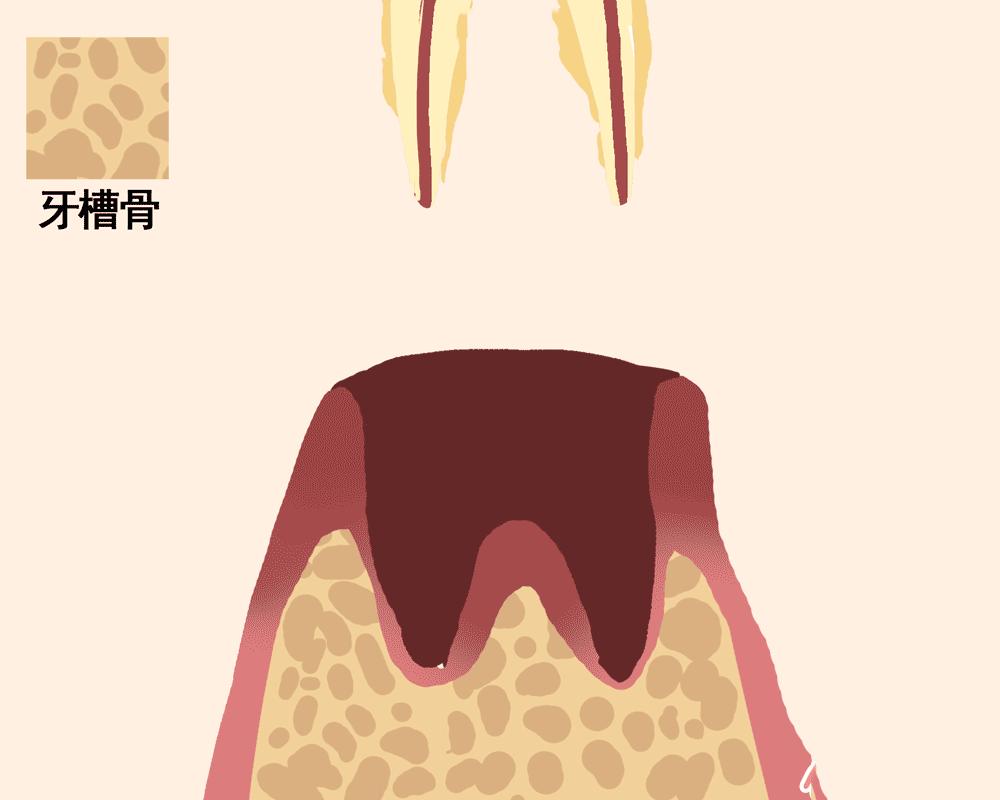 牙齿脱落的顺序图,一张动图告诉你