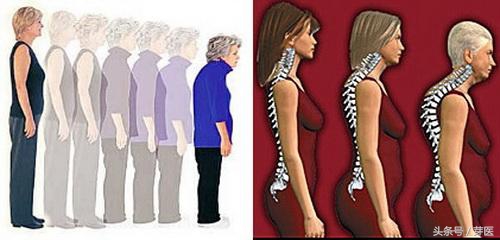 身体过早衰老还能活多久,提前衰老的四大征兆需要引起关注