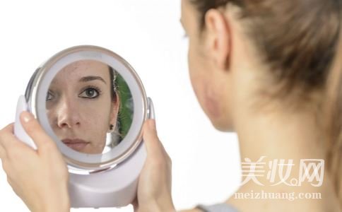 孕期长痘痘怎么办最快消除,孕期长痘痘可以擦蜂蜜吗