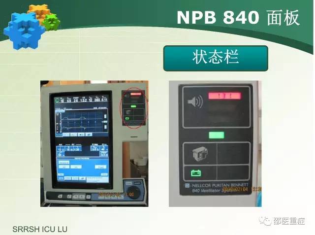 有创机械通气操作,机械通气英文缩写