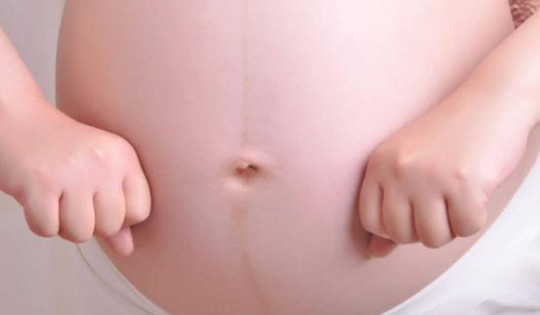 怀孕看肚子上的线准吗偏左偏右,怎么看妊娠线偏左还是偏右图片