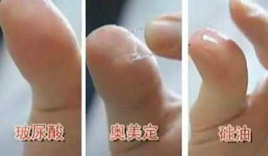 注射液怎么辨别真假,怎么辨别注射产品真假