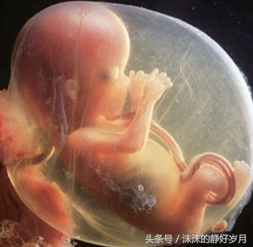 亲爱的宝宝请不要焦虑,4个月的胎宝宝会脐带绕颈吗