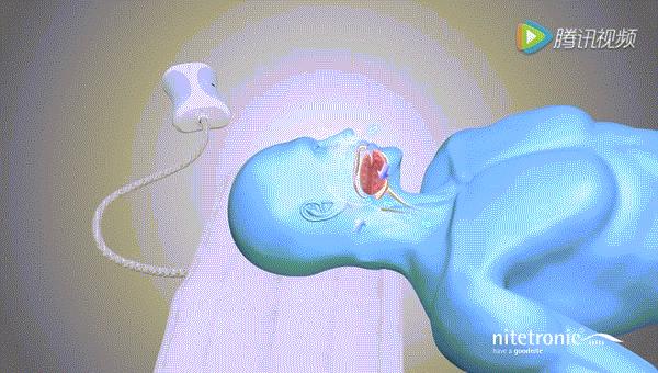 德国黑科技治疗打呼噜的枕头测评,德国枕头治疗打鼾