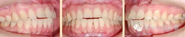 是谁将孩子推入网络深渊,是谁把宝宝推下了台阶