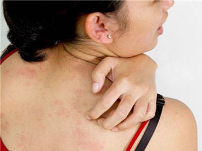 湿疹奇痒难忍怎么治疗,湿疹反复发作奇痒中医给两种方法