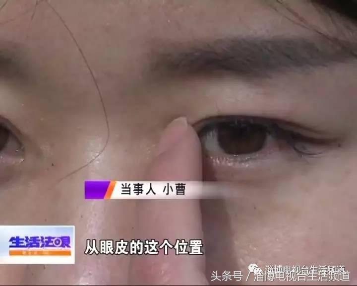 女子开眼角半年后遭罪再找店家工作人员却坚称不认识她