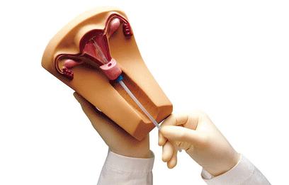 节育环取出关注些什么,女性节育环取环前关注事项