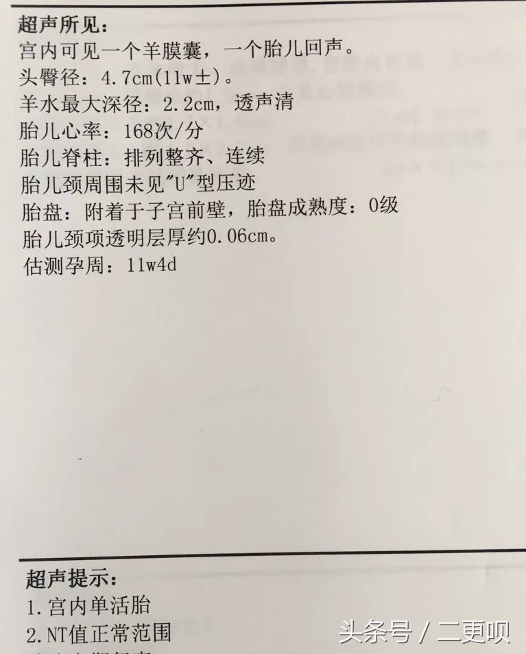 nt检查11周去还是12周去比较好,孕12-16周做nt检查需要关注什么