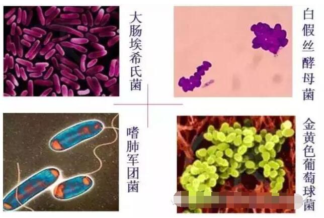 空调感温头故障维修图,空调感温头故障维修