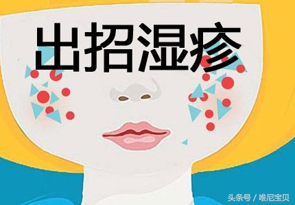 宝宝反复湿疹对付湿疹有妙招,反复湿疹怎么治才能除根