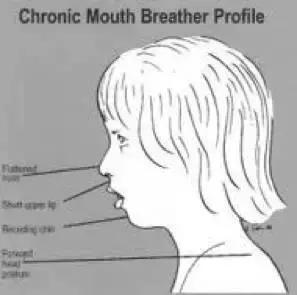 是谁将孩子推入网络深渊,是谁把宝宝推下了台阶