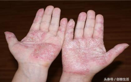 几元钱一瓶的药能治大病,一瓶才6粒的胃药