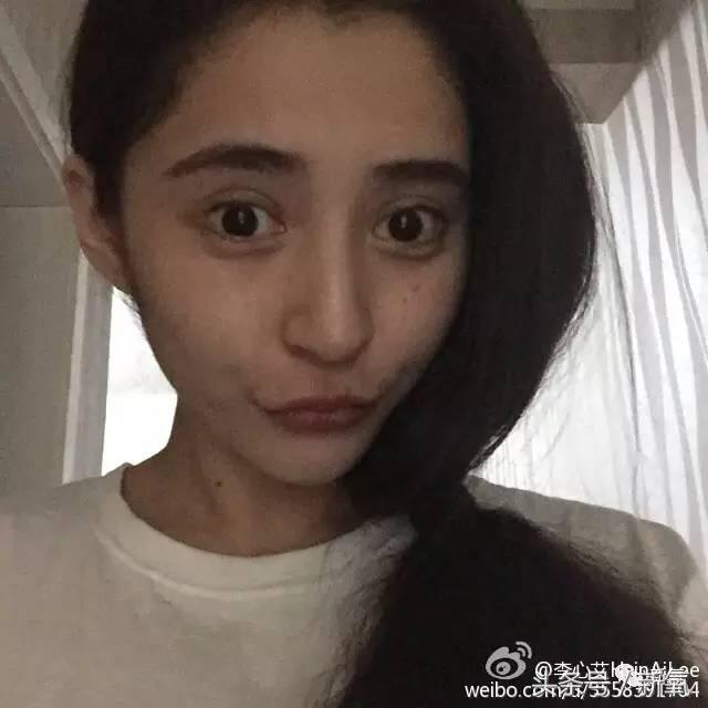 为什么开眼角会变漂亮,为什么开眼角很奇怪