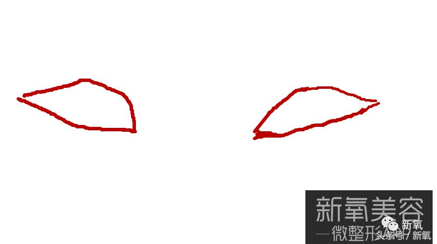 为什么开眼角会变漂亮,为什么开眼角很奇怪