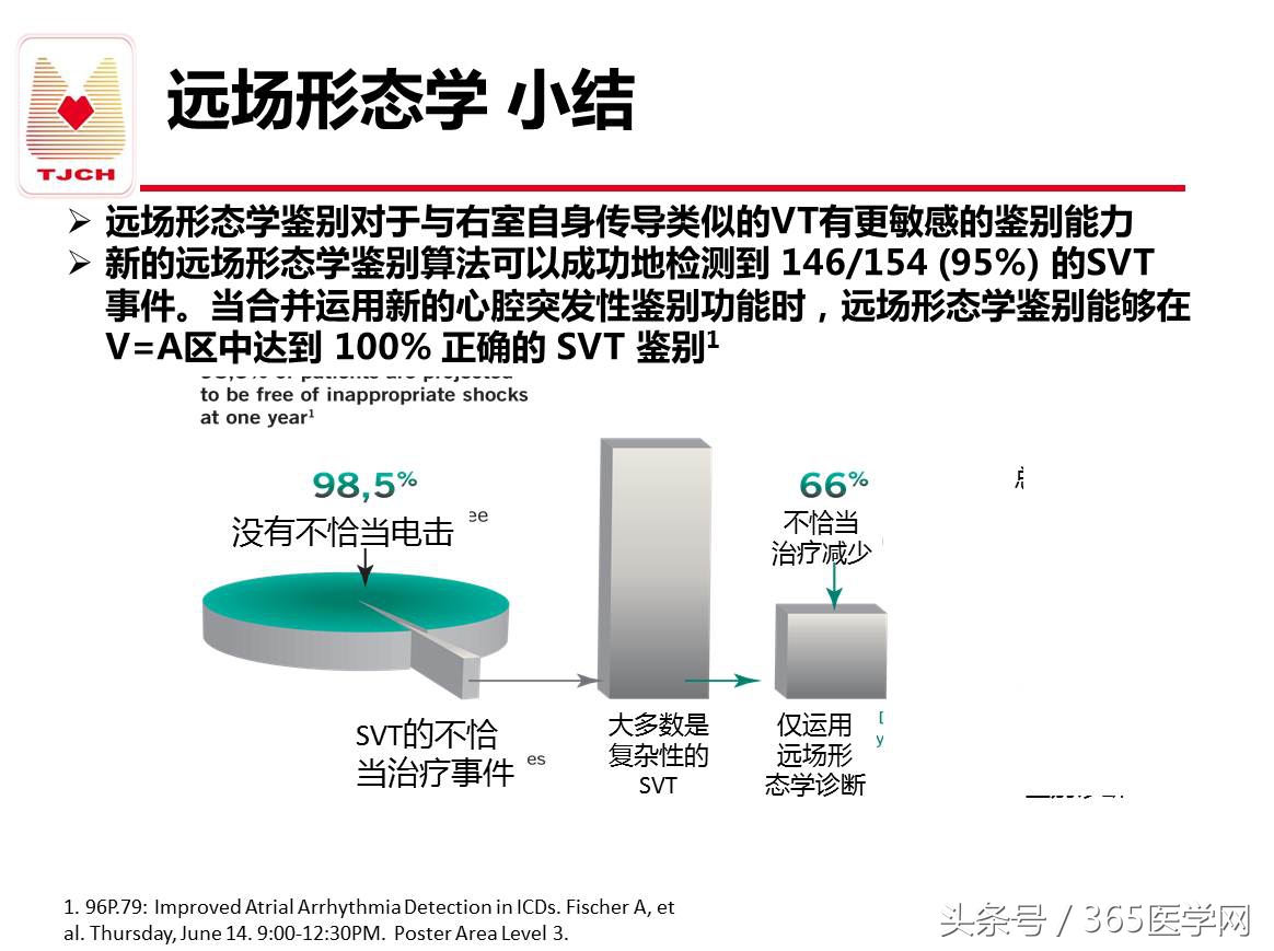 许静：新技术避免ICD不恰当放电