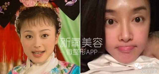 为什么开眼角会变漂亮,为什么开眼角很奇怪