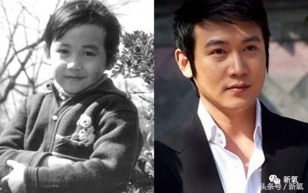 为什么开眼角会变漂亮,为什么开眼角很奇怪