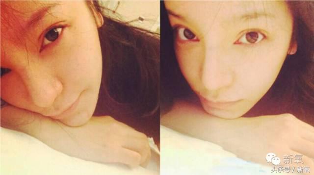 为什么开眼角会变漂亮,为什么开眼角很奇怪