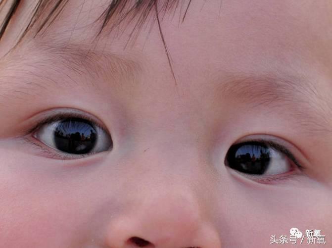 为什么开眼角会变漂亮,为什么开眼角很奇怪