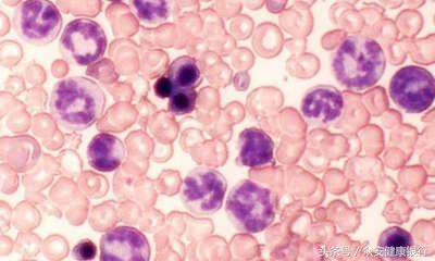 最好的白血病靶向药是哪种,最新出来的治疗白血病的靶向药物