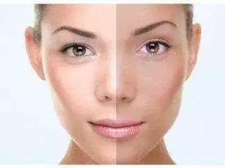 脸色痘印残留的黑色怎么才能消除,斑点痘印皮肤暗沉怎么改善