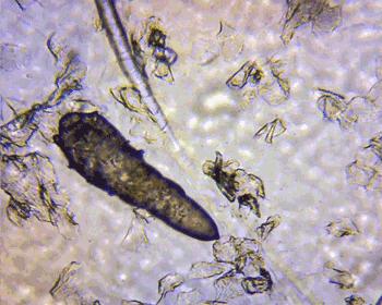 狗狗耳朵上有螨虫图,狗狗螨虫去除全过程