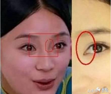 为什么开眼角会变漂亮,为什么开眼角很奇怪