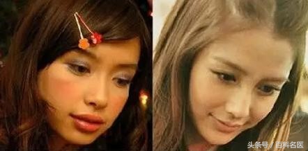 牙齿畸形的六个表现,牙齿畸形矫正图片大全