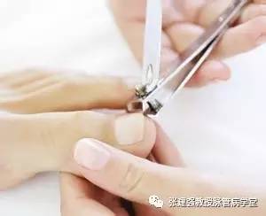 糖尿病足溃疡治疗方法,糖尿病足慢性溃疡修复术