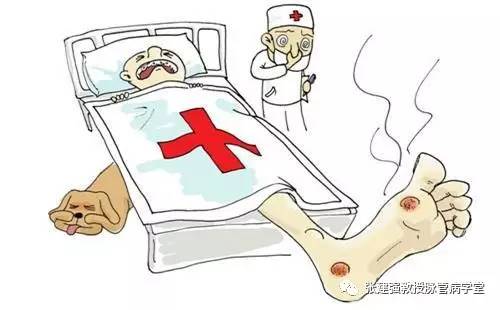 糖尿病足溃疡治疗方法,糖尿病足慢性溃疡修复术