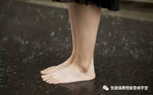 糖尿病足溃疡治疗方法,糖尿病足慢性溃疡修复术