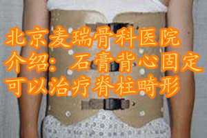 脊柱畸形最好的治疗,脊柱畸形有什么方法可以矫正