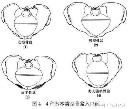 产后骨盆和正常骨盆的区别,骨盆测量有意义吗