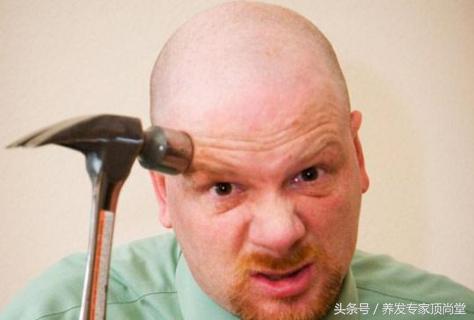 脱发的焦虑谁能懂,脱发危机感