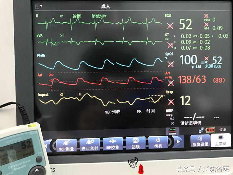 全麻影响智力解读麻药的四个误区,全麻对小孩有什么风险