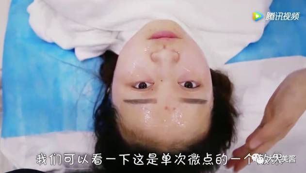 视频｜还没到30，皮肤松弛了？不开刀也不疼的射频提升？