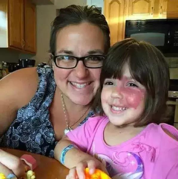 女儿有红胎记，妈妈是这样做的！