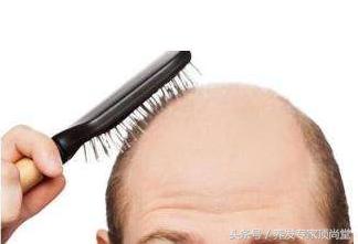 脱发的焦虑谁能懂,脱发危机感