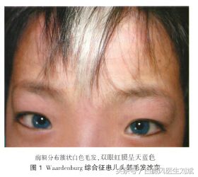 色素沉着会患白癜风吗,手上长白斑一定是白癜风吗