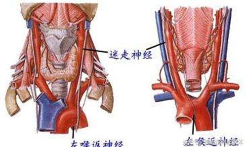 掏耳朵嗓子痒想咳嗽,掏耳朵喉咙痒咳嗽怎么回事