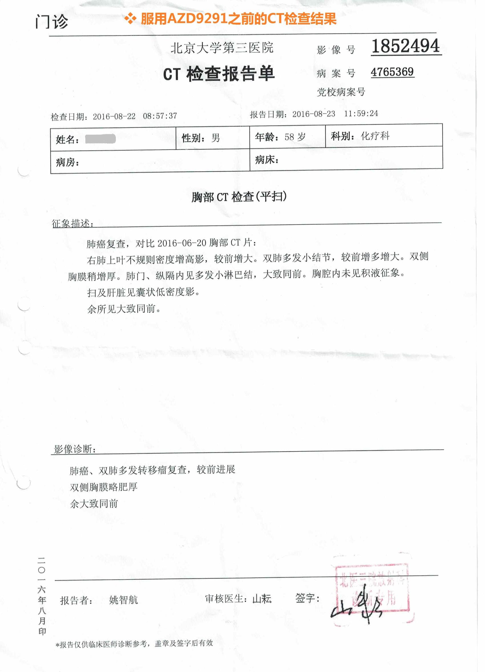 azd9291靶向药价格,azd9291去哪里买