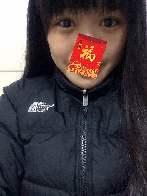 全切双眼皮20天了还一大一小,全切双眼皮的第二个月不来大姨妈