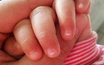 准妈妈实用技能：如何判断宝宝得了蛔虫病附治疗方式