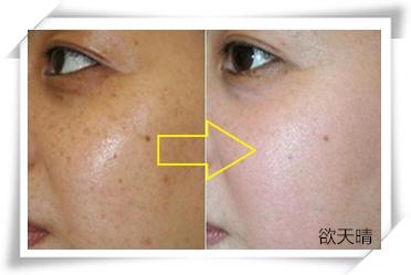 药店1块钱买来的它，每晚睡前抹上一点，祛除眼袋抚平皱纹显年轻