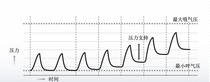 单水平和双水平呼吸机差别很大吗,单水平跟双水平呼吸机区别