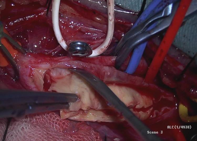 改善脑供血不够的药有哪些,脑供血不够常敲打3个穴位