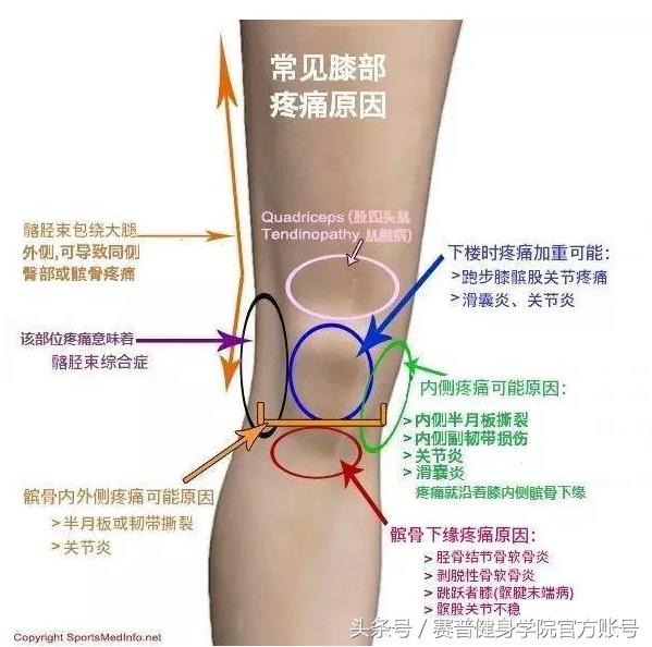 健身族如何预防膝关节疼痛,健身膝盖损伤怎么恢复