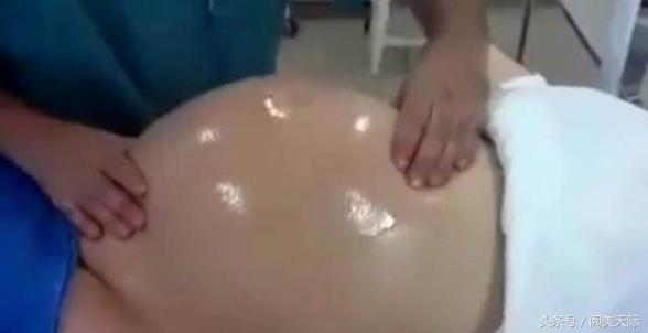 孕妇胎位不正猛压肚子30下,孕妇胎位不正按压肚子纠正